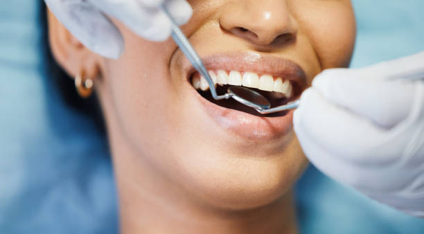 Best Emergency Broken Tooth Repair in Jackson, MS